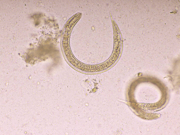istock Strongyloides stercoralis in human stool 1218588102