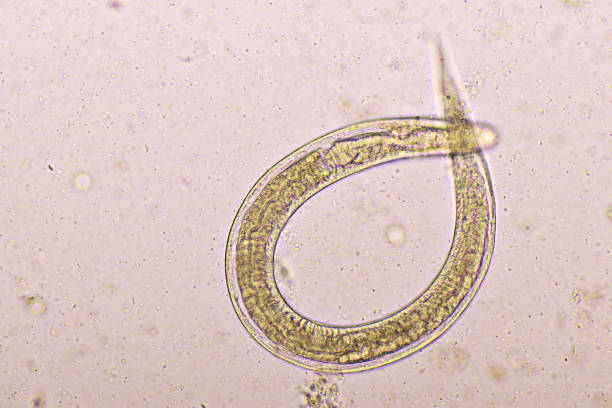 istock Strongyloides stercoralis in human stool 1218588130