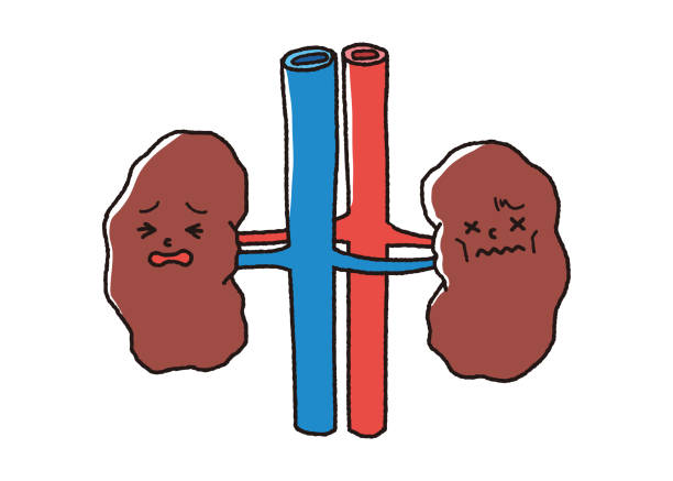 Kidney Failure Illustrations, Royalty-Free Vector Graphics & Clip Art -  iStock