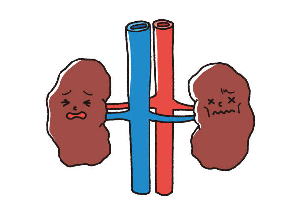 Kidney Failure Illustrations, Royalty-Free Vector Graphics & Clip Art - iStock Kidney Failure Illustrations, Royalty-Free Vector Graphics & Clip Art - iStock
