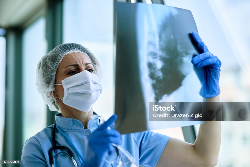 Female doctor examining patient's chest X-ray at the hospital. Female radiologist analyzing chest X-ray of an patient at medical clinic during coronavirus epidemic. X-ray Image Stock Photo