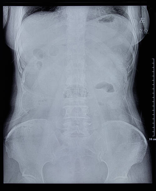 imagen de rayos x humano - cat scan abdomen medical scan x ray fotografías e imágenes de stock