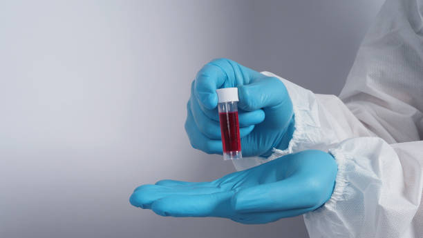 Blood tests in clear tube on doctor hands with blue medical gloves and PPE suit which represent coronavirus or 2019-ncov or covid-19 pandemic screening test that positive results or infected Blood tests in clear tube on doctor hands with blue medical gloves and PPE suit which represent coronavirus or 2019-ncov or covid-19 pandemic screening test that positive results or infected antibody test stock pictures, royalty-free photos & images