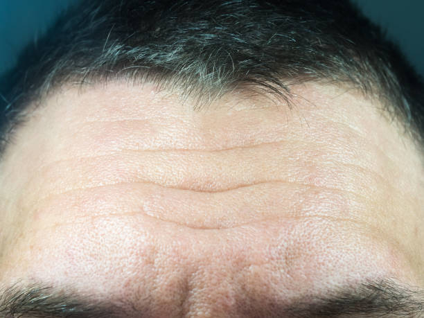 Closeup photo of a male forehead with deep wrinkles and pores Closeup photo of male forehead with deep wrinkles and pores wrinkled forehead stock pictures, royalty-free photos & images