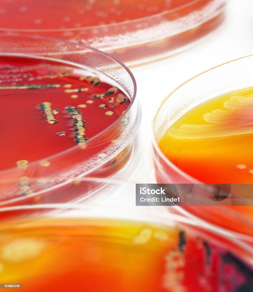 Microbiologie: Des cultures bactérienne - Photo de Agent pathogène libre de droits