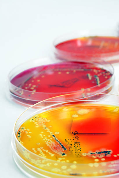 Microbiology: Colourful bacterial Cultures stock photo