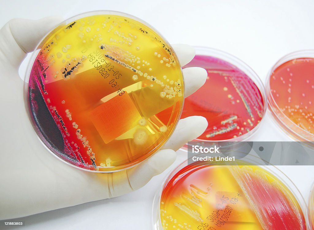 Microbiologia: Colorido de culturas de fungos - Foto de stock de Analisar royalty-free