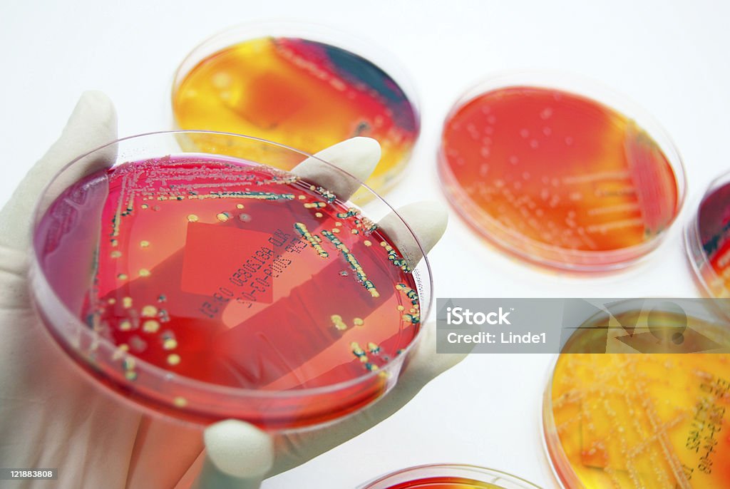 Microbiology: Colourful bacterial Cultures  Agar Jelly Stock Photo