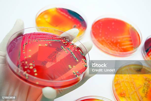 Microbiology Colourful Bacterial Cultures Stock Photo - Download Image Now - Agar Jelly, Analyzing, Bacterium