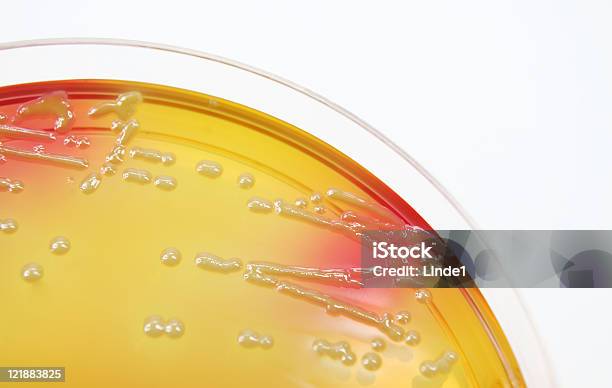 Microbiología Un Cultivo Bacteriano Foto de stock y más banco de imágenes de Agar-agar - Agar-agar, Analizar, Asistencia sanitaria y medicina