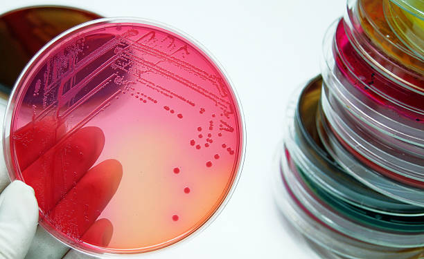 E.coli on Maconkey agar, Microbiologist at work stock photo