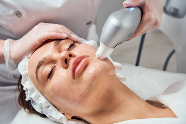 ultraformer lifting. face skin care. close-up of woman getting facial hydro microdermabrasion peeling treatment at cosmetic beauty spa clinic. hydra vacuum cleaner. exfoliation, rejuvenation and hydratation. cosmetology - alternative therapy massaging clinic health spa imagens e fotografias de stock