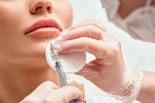 lippenformkorrekturverfahren in einem kosmetologie-salon. der spezialist macht eine injektion auf die lippen des patienten. lippenvergrößerung - botox injection stock-fotos und bilder