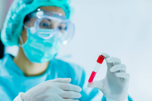 Medical scientists in PPE with the blood sample for patients infected coronavirus; covid-19 perform analysis in laboratory, RT-PCR test and Rapid test stock photo
