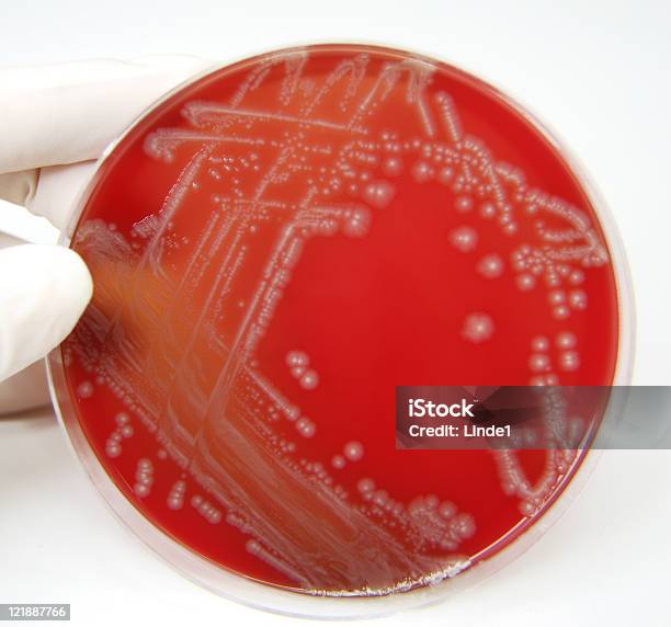 Bakterii E Coli - zdjęcia stockowe i więcej obrazów Bakteria - Bakteria, Szalka petriego, Wzrost