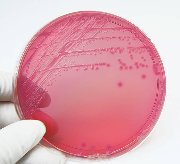 대장균 - fecal coliform bacteria 뉴스 사진 이미지