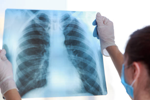 istock Doctor examines an X-ray 1218989471