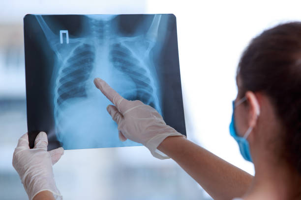 istock Doctor examines an X-ray 1218989507
