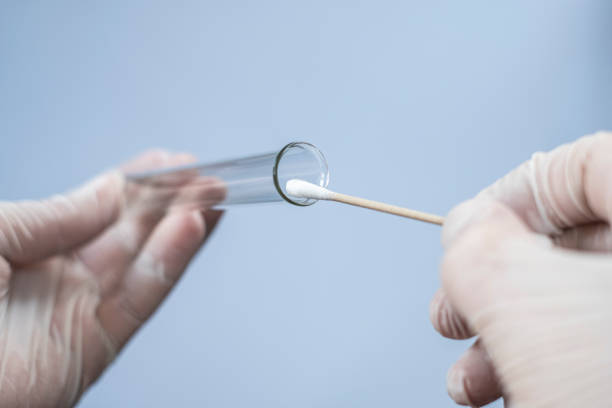 tube à essai en verre et coton-tige dans les mains d’un scientifique. un virologue en caoutchouc de gants jetables tient un flacon de laboratoire et pour analyse. il a prélevé un échantillon de frottis pour un test de coronavirus - genetic research men substances analyzing photos et images de collection