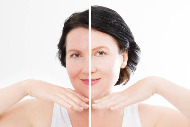 middle age close up woman happy face before after cosmetic procedures. skin care for wrinkled face. before-after anti-aging facelift treatment. facial skincare and contouring. beauty and make-up - teenager body care adolescence human lips imagens e fotografias de stock