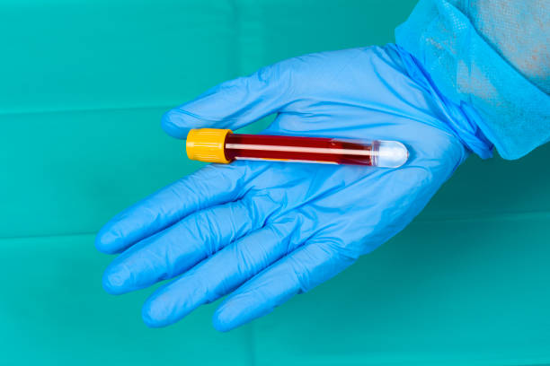 A young doctor in medical uniform with gloved hand testing blood samples for virus. Coronavirus conceprt. Covid-19 epidemic. Copy space. Medical infects stopping