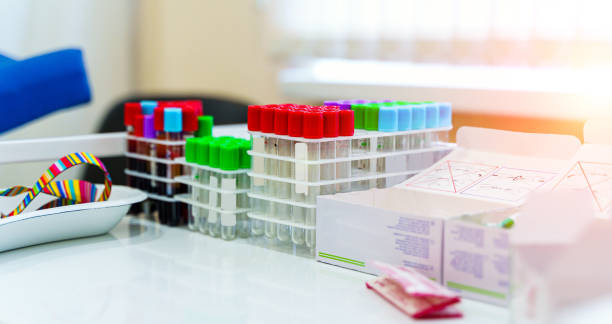 test tubes for blood on a tray. - multi well trays imagens e fotografias de stock