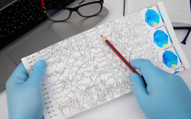 a neurologist examines an encephalogram of a patient’s brain. schedule of electroencephalograms - study of brain currents for signs of epilepsy and pathologies of the nervous system - pulse trace computer monitor eeg equipment imagens e fotografias de stock