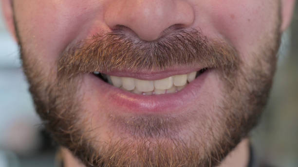 istock Close Up of Smiling White Young Man with Healthy Teeth 1219310843