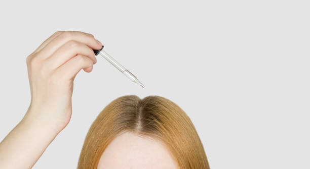 8,382 Scalp Treatment Stock Photos, Pictures & Royalty-Free Images - iStock | Hair and scalp treatment 8,382 Scalp Treatment Stock Photos, Pictures & Royalty-Free Images - iStock | Hair and scalp treatment