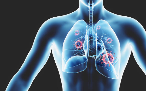 istock Coronavirus cells in human lungs, x-ray. Medical and science 1219421800