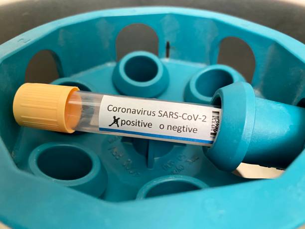istock SARS-CoV-2 test in centrifuge 1219450024