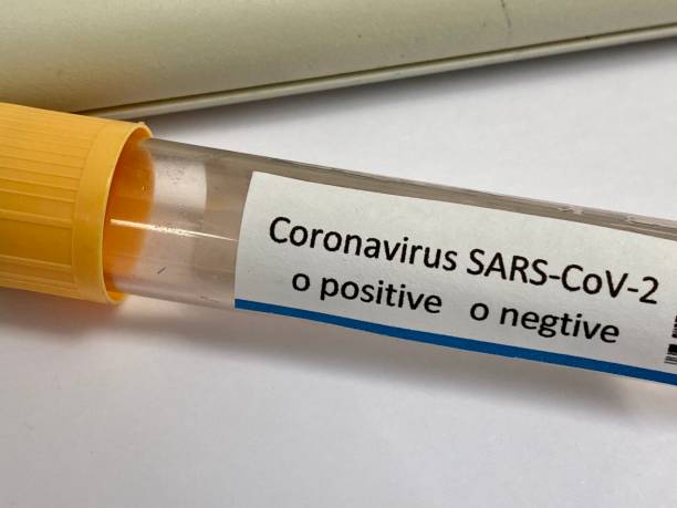 istock SARS-CoV-2 test tube 1219450647