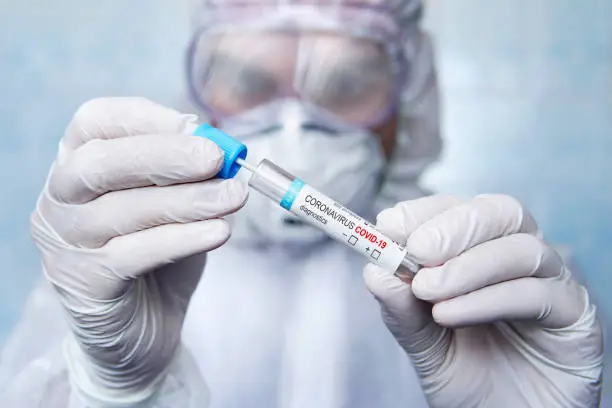 Coronavirus Covid-19 respiratory sputum specimen swab test tube with gloves, mask. a specialist in a protective suit examines the sample virus SARS-CoV-2. examination of sputum with suspected covid-19