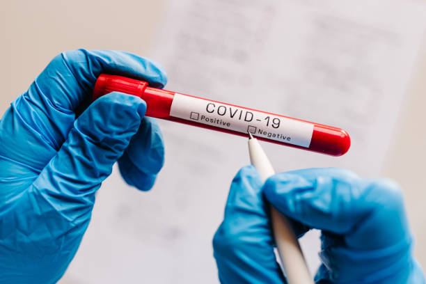 코비드-19 텍스트입니다. 의사, 간호사, 과학자의 손이 펜으로 쓰고 부정적인 결과를 확인하고 생물학적 샘플로 시험관을 잡습니다. 코로나 바이러스. 혈액은 감염되지 않습니다. 치료의 새로운  - 과학 실험 뉴스 사진 이미지