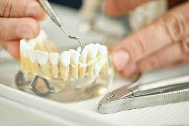 Dental technician examining a prosthetic tooth Close-up of a dental technician shaping a prosthesis tooth with a tool at work desk dental crown stock pictures, royalty-free photos & images