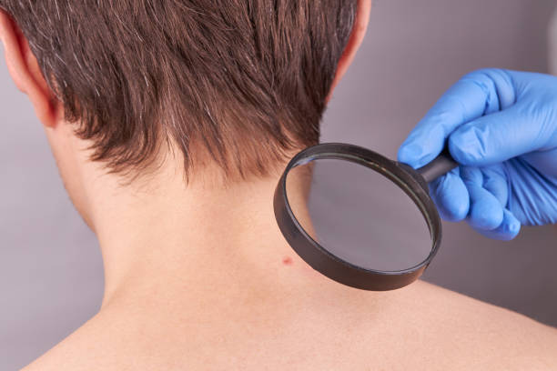istock caucasian male with skin problems. acne check. skin care concept. 1219614569