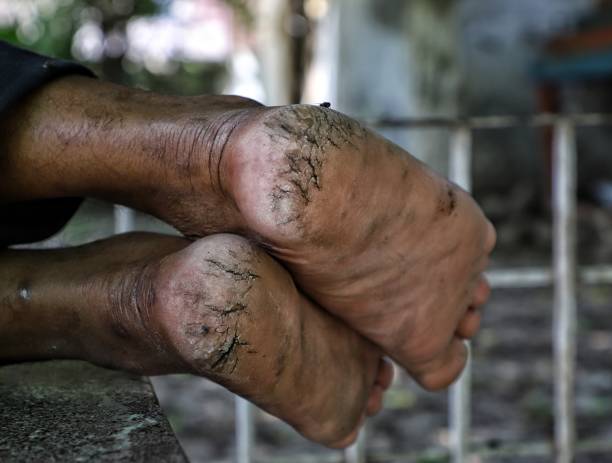 istock close up of barefoot of a worker 1219661737