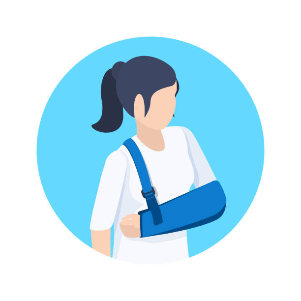 broken arm isometric vector image on a blue background, a woman with a broken arm, treatment of injuries and bondage for the hand arm sling stock illustrations