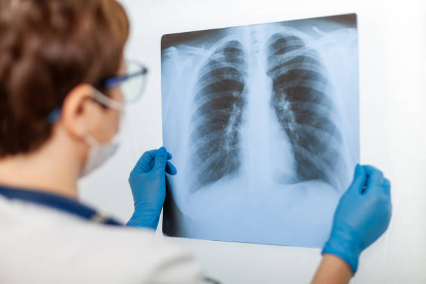 una dottoressa esamina una radiografia del polmone di una paziente infettata da coronavirus covid-19, polmonite. raggi x di luce. fluorografia. controllare i polmoni in ospedale. raggi x reali dei polmoni umani - human lung x ray image x ray human spine foto e immagini stock