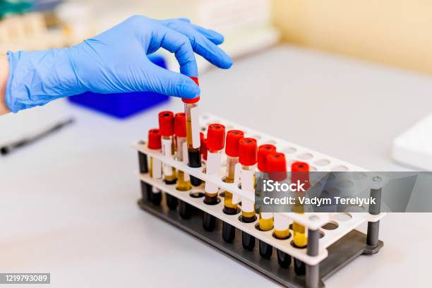 Blood Samples For Research In Microtubes Stock Photo - Download Image Now - Blood Test, Leukemia, Hematology