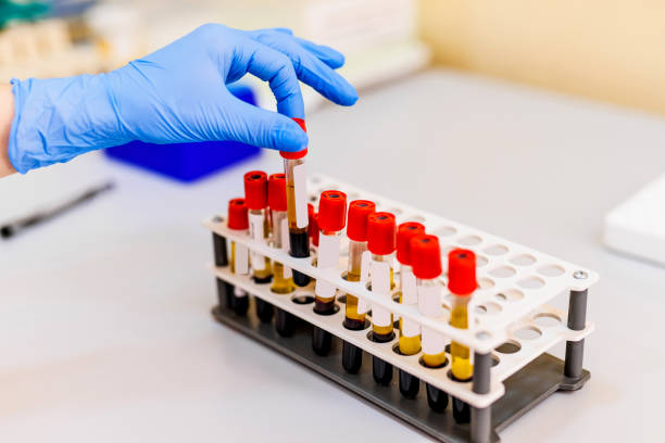 blood samples for research in microtubes. - multi well trays imagens e fotografias de stock