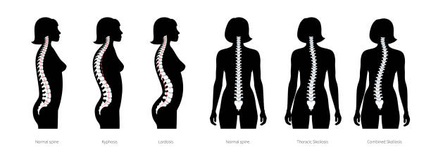 deformacja kręgosłupa płaska ilustracja wektorowa - sacrum stock illustrations