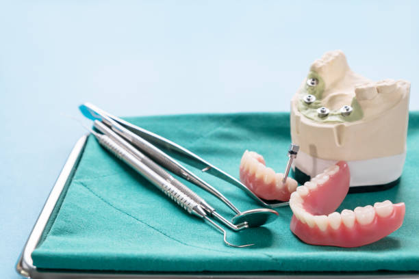 istock Dental implant work is completed and ready to use. 1219830407