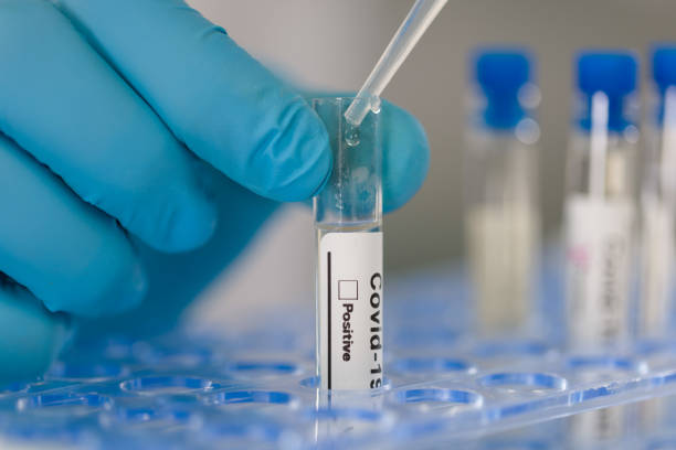 istock close up of working on test tubes for coronavirus tests 1219867171