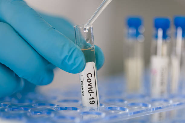 istock close up of working on test tubes for coronavirus tests 1219867184