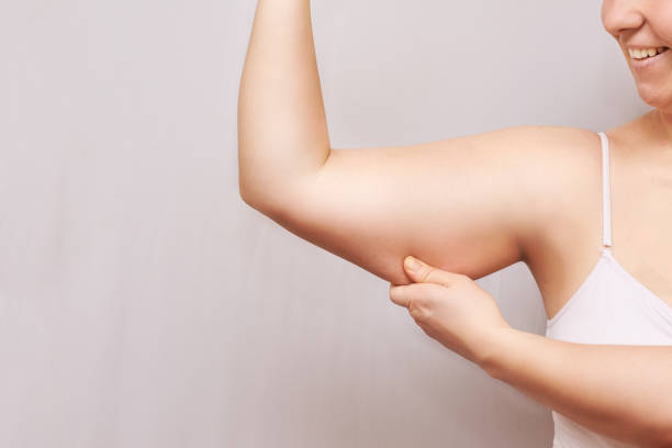 young woman pinch fat arm. hand pinching body. fenale person showing overweight - muscular build bicep women female imagens e fotografias de stock