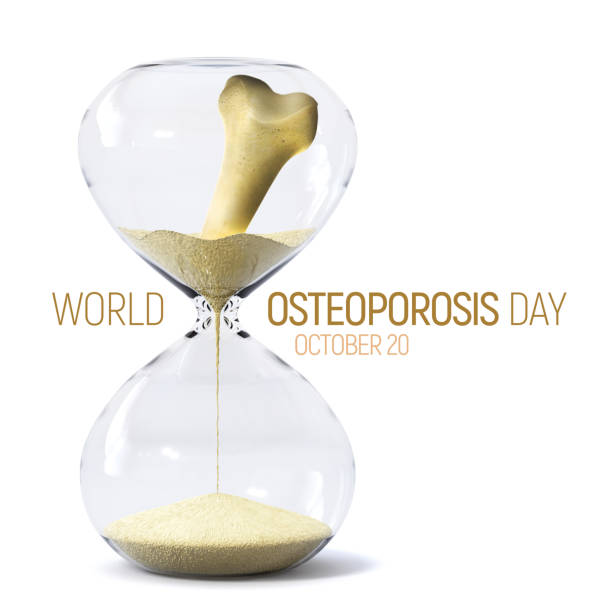 20 октября всемирный день остеопороза концепт-арт, показывающий проблемы, происходящие во время заболевания костей, что приводит к повышенн - timer minute hand number 20 hourglass стоковые фото и изображения