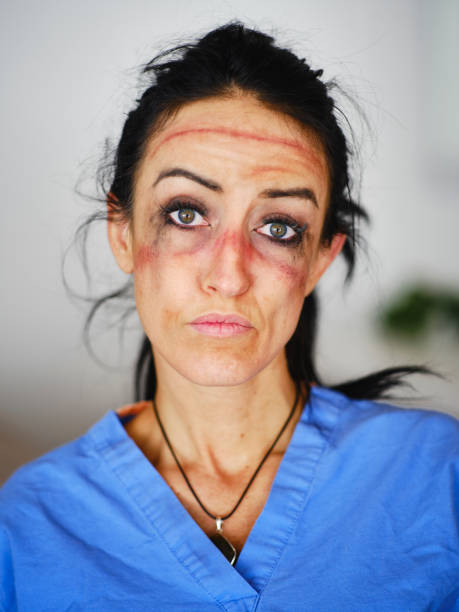 A healthcare worker showing the signs of fatigue from working long hours combatting communicable disease in a hospital.