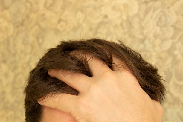 istock Forehead, upper part of a man's face 1220067241