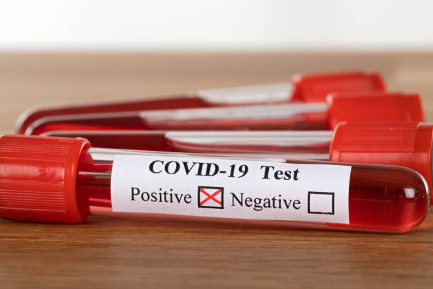 istock Covid-19 blood test 1220117881